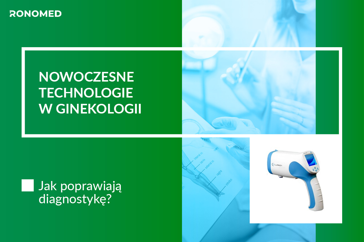 Nowoczesne technologie w ginekologii — jak poprawiają diagnostykę?
